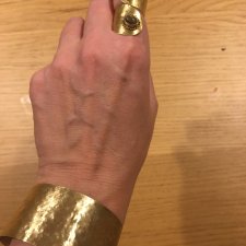 Pierścionek i bransoletka